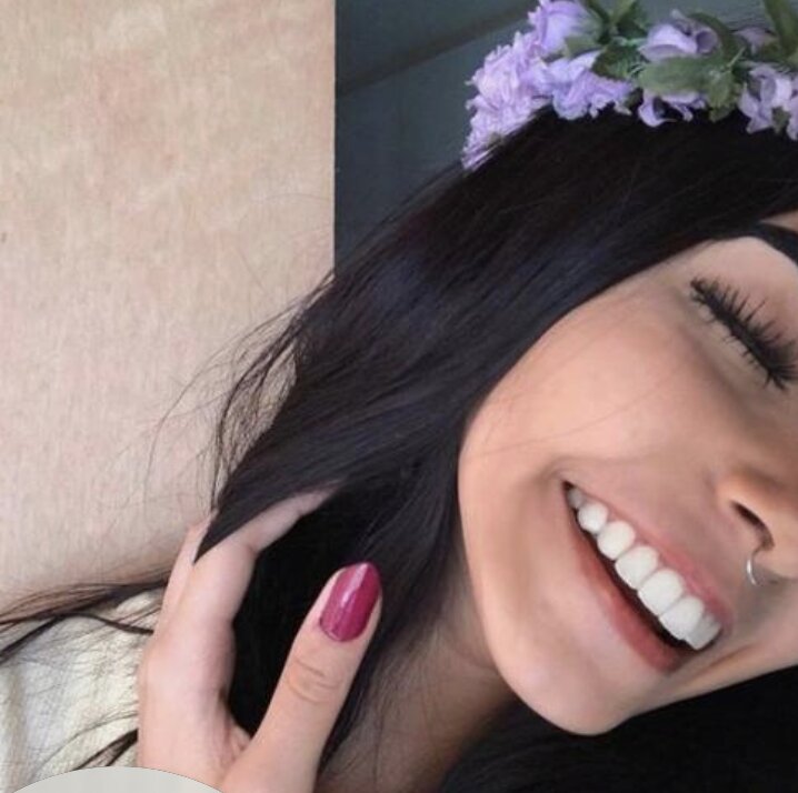 files/Review_7_Veneers.jpg